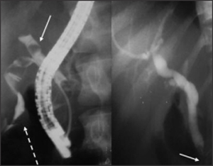 Gastroenterology : Diagnostic & Therapeutic